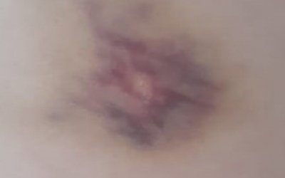 Professora é agredida por aluna em sala de aula em Guaraí; caso é investigado pela Polícia Civil