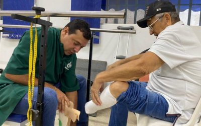 Governo do Tocantins entrega próteses para pacientes de Araguaína e região