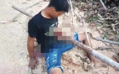 Homem fica com tronco atravessado no corpo após acidente de moto