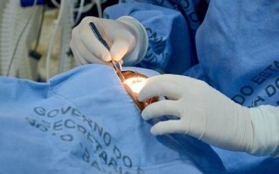 Tocantins já realizou mais de 300 transplantes de córneas