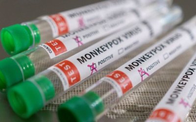 Tocantinense diagnosticado com varíola dos macacos é de  Nazaré