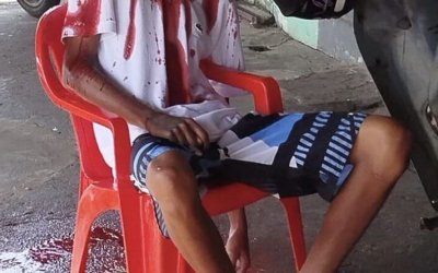 Jovem morto a tiros em Guaraí é identificado: vítima tinha 16 anos e foi executada no Setor Universitário