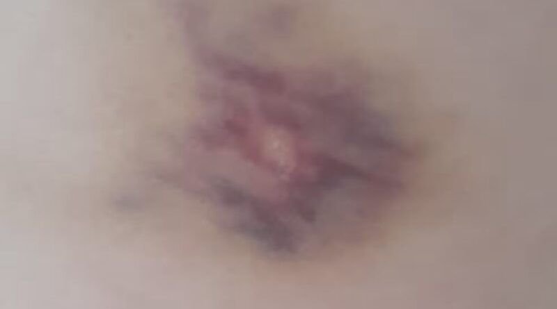 Professora é agredida por aluna em sala de aula em Guaraí; caso é investigado pela Polícia Civil