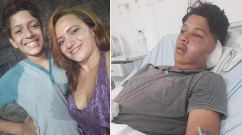 Adolescente de Araguaína baleado pelo próprio pai já arrecadou R$ 100 mil para tratamento médico e recomeço de vida