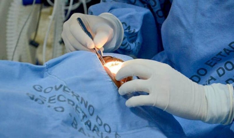 Tocantins já realizou mais de 300 transplantes de córneas