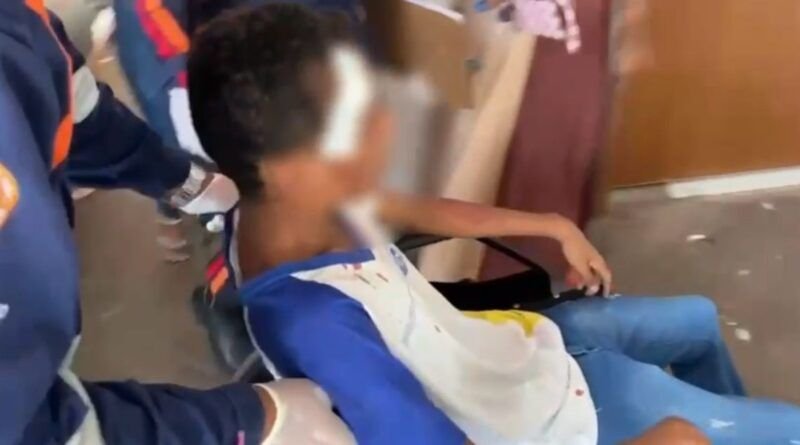 Aluno de 15 anos é esfaqueado na cabeça na saída de escola em Araguaína