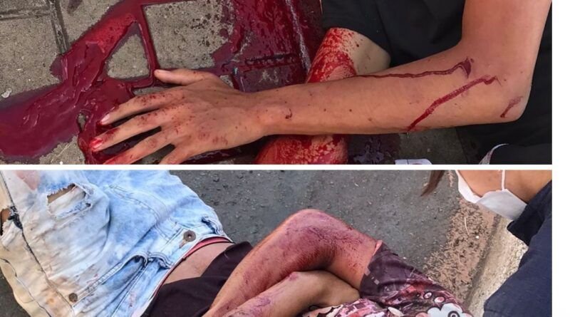 Dupla em motocicleta fica gravemente ferida após colisão com ônibus em Araguaína